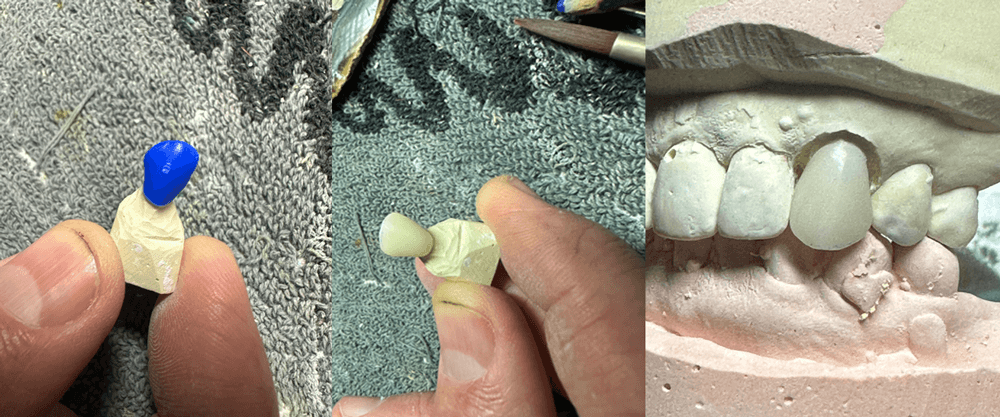 Creating a-Dental Crown