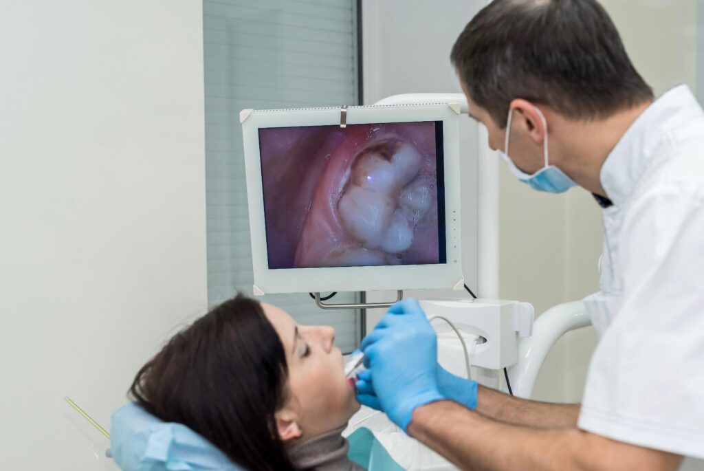 dental intraoral scanner